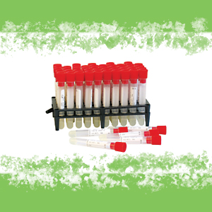 PROVETTE IN PP CON GEL SEPARATORE DI SIERO 5 ML