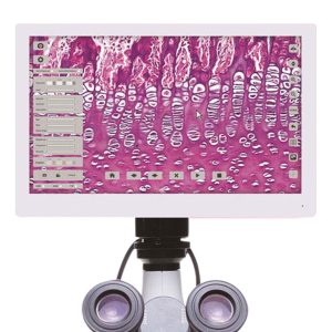 TELECAMERA DIGITALE A COLORI ISDV 5000HDL COMPLETA DI MONITOR 11"