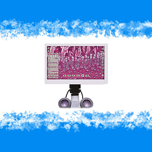 TELECAMERA DIGITALE A COLORI ISDV 5000HDL COMPLETA DI MONITOR 11"